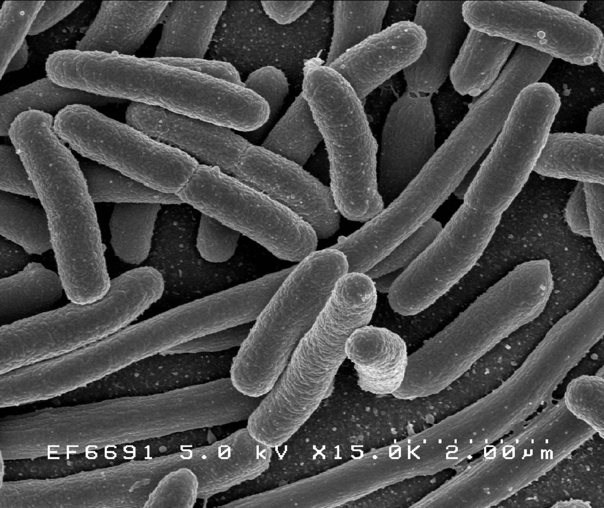 Imagem de referência de Escherichia coli, descrito nos dados abertos como bactéria gram-negativa
