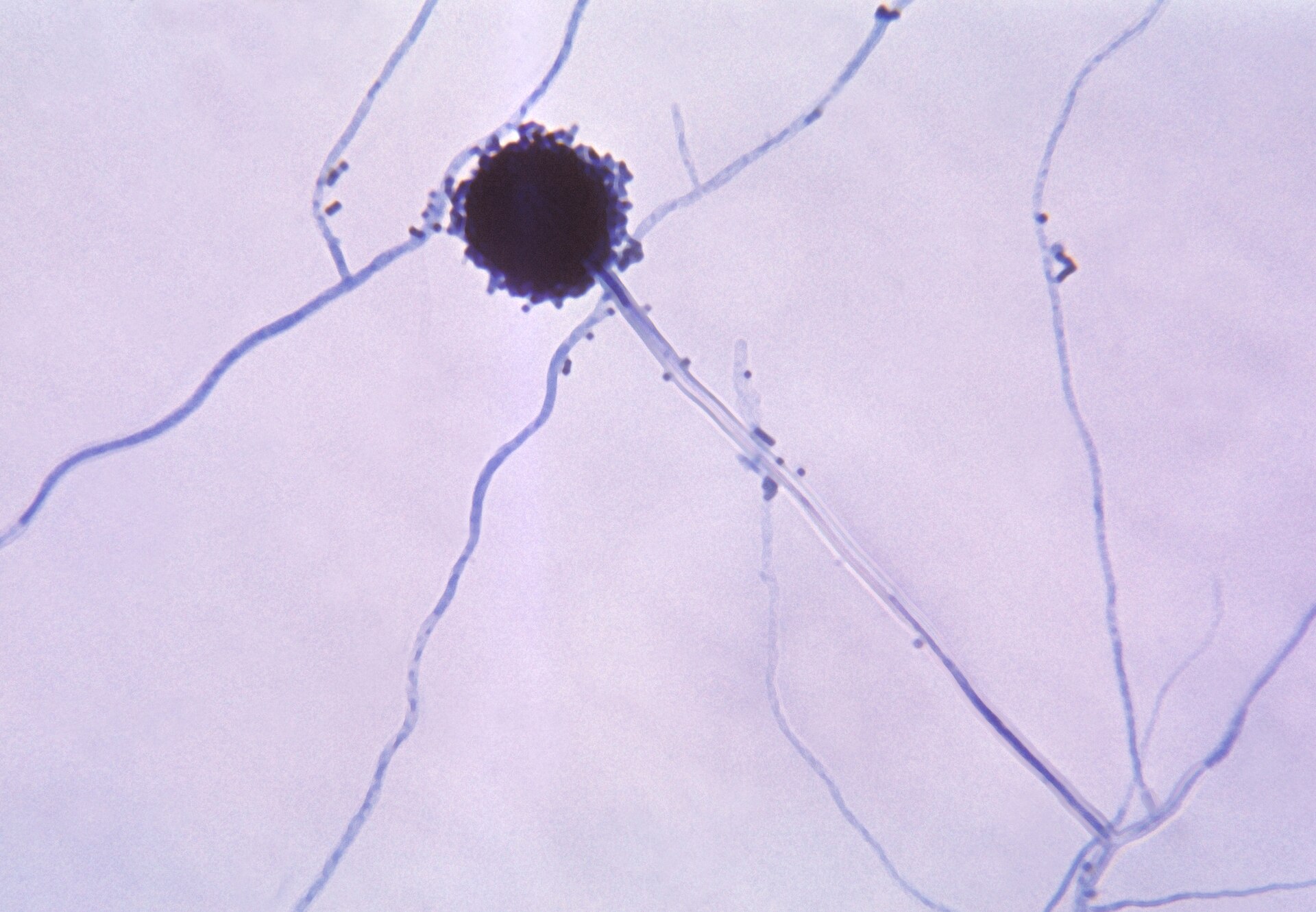 Imagem de referência de Aspergillus, descrito nos dados abertos como género de fungos