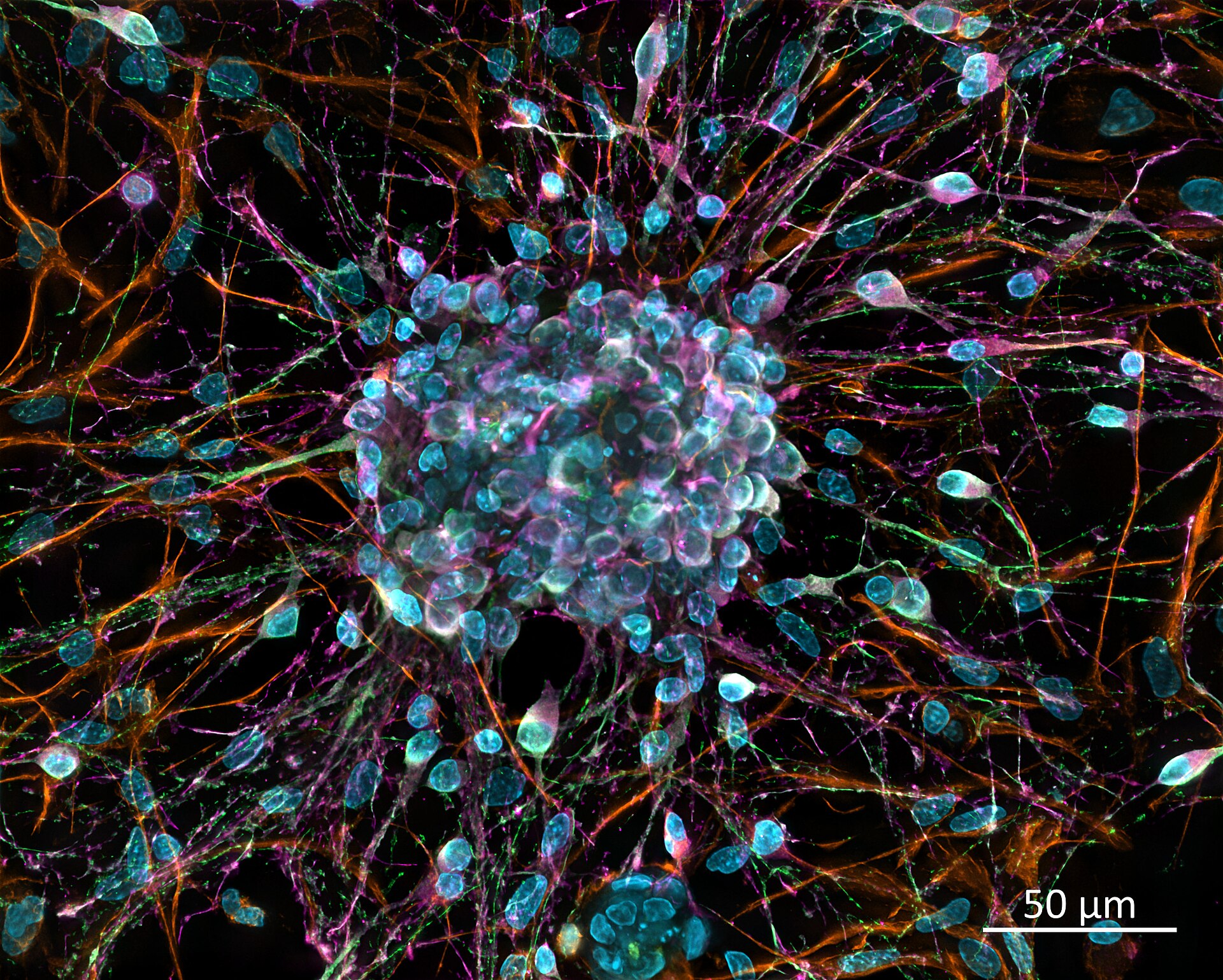 Imagem de referência de neurónio, descrito nos dados abertos como célula do sistema nervoso