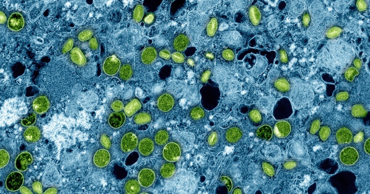 Imagem relacionada à notícia: Grã-Bretanha reporta quatro novos casos de Mpox